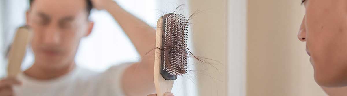 남성탈모이미지