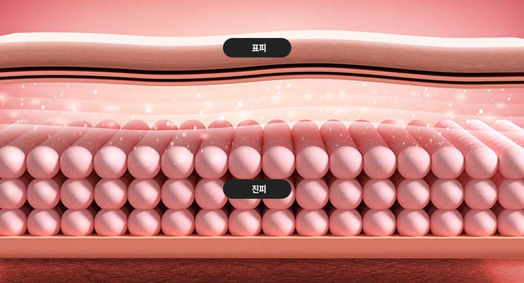 기존레이저 세포 이미지